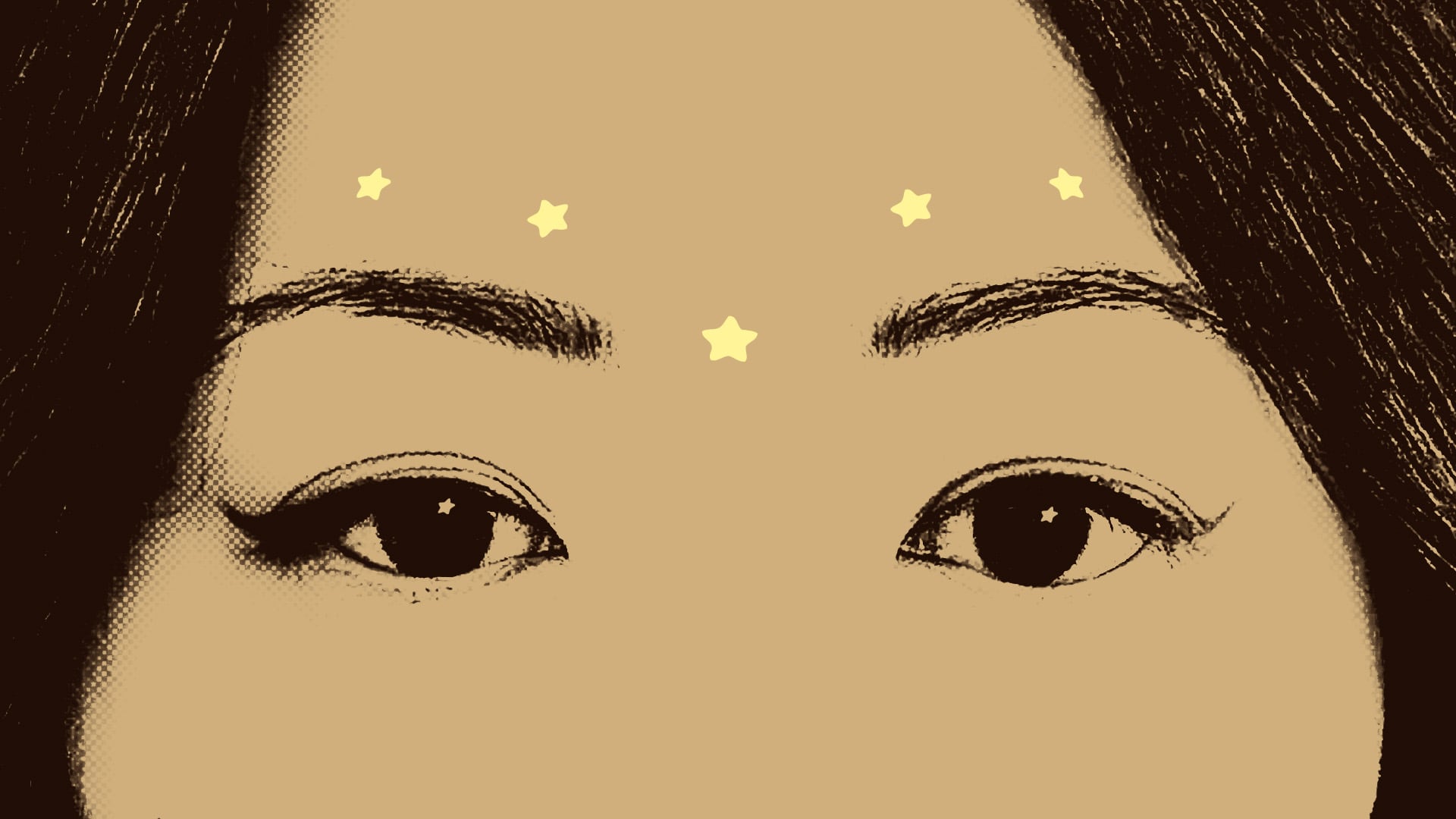 Baby Botox Softened My Fine Lines Without Freezing My Face