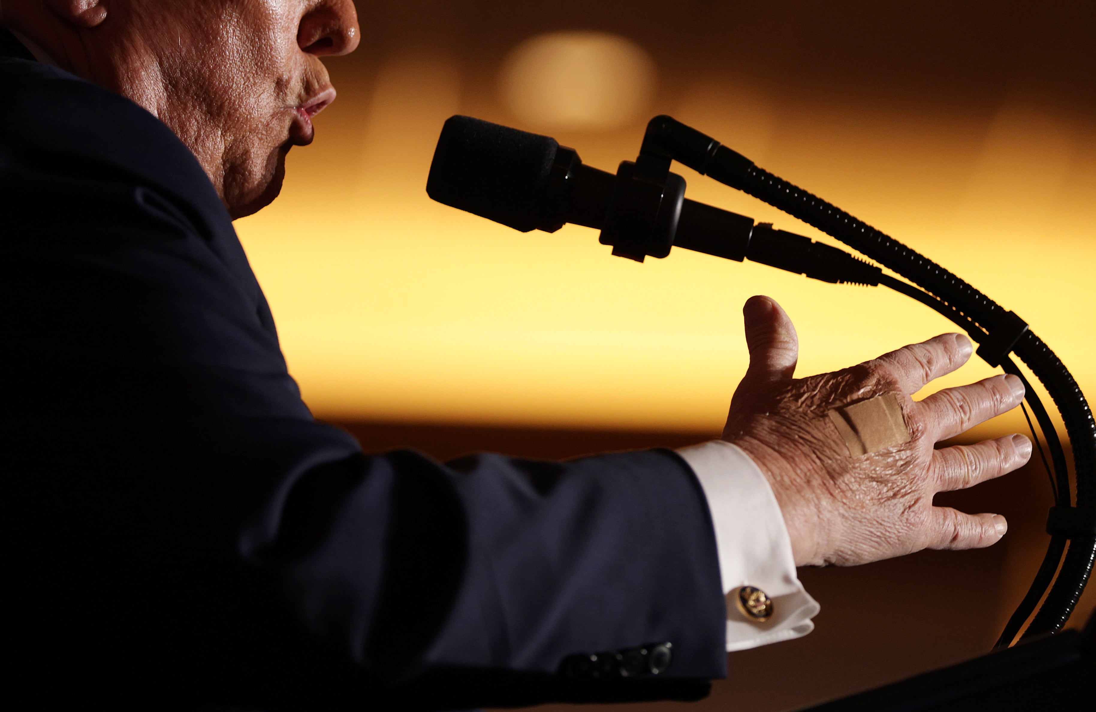 A bandage is visible on U.S. President Donald Trump's right hand as he delivers remarks during an event at Mount Airy Casino Resort on December 9, 2025 in Mount Pocono, Pennsylvania. / Alex Wong / Getty Images